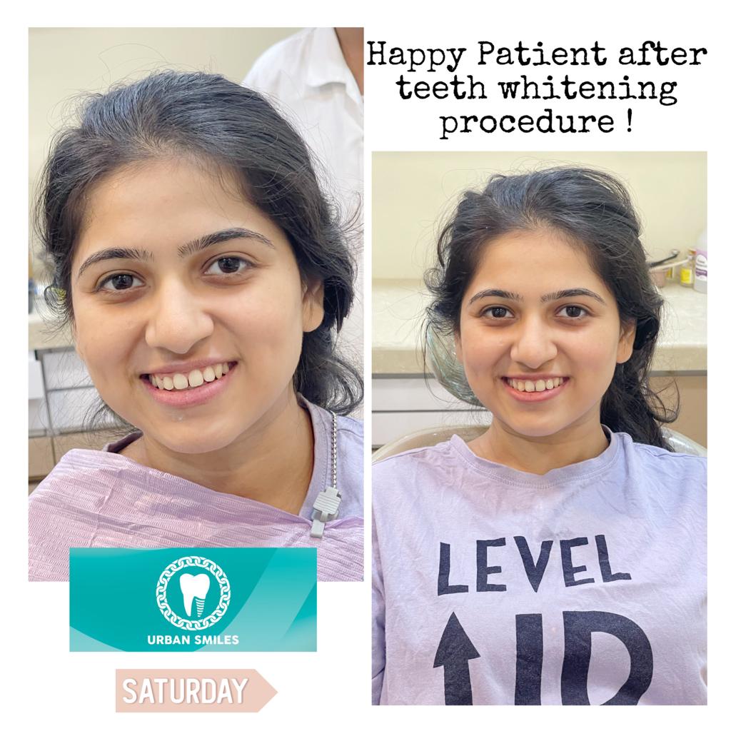 Urban Smiles Dental Care — Chembur