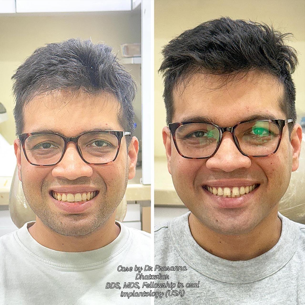 Urban Smiles Dental Care — Chembur