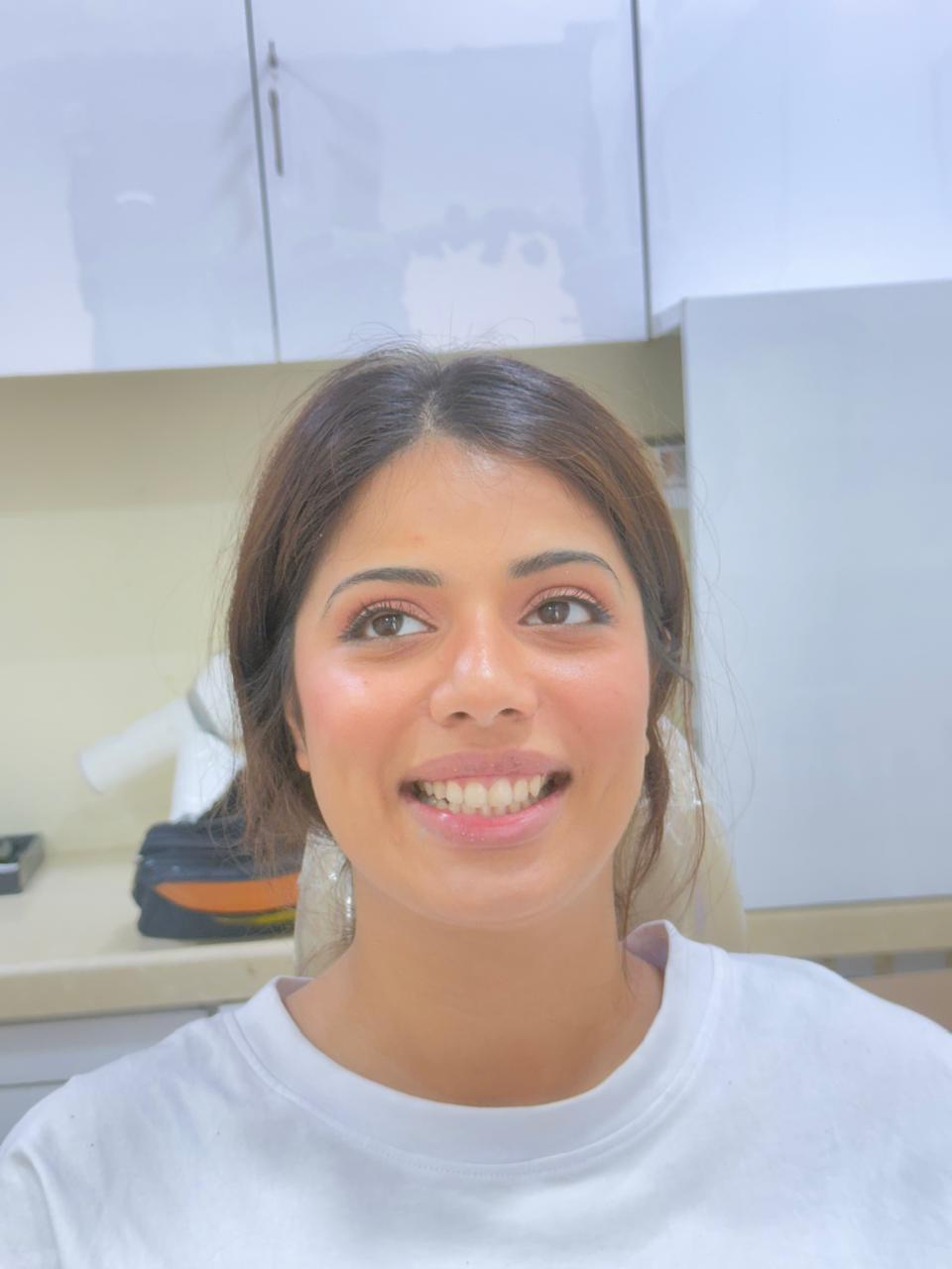 Urban Smiles Dental Care — Chembur