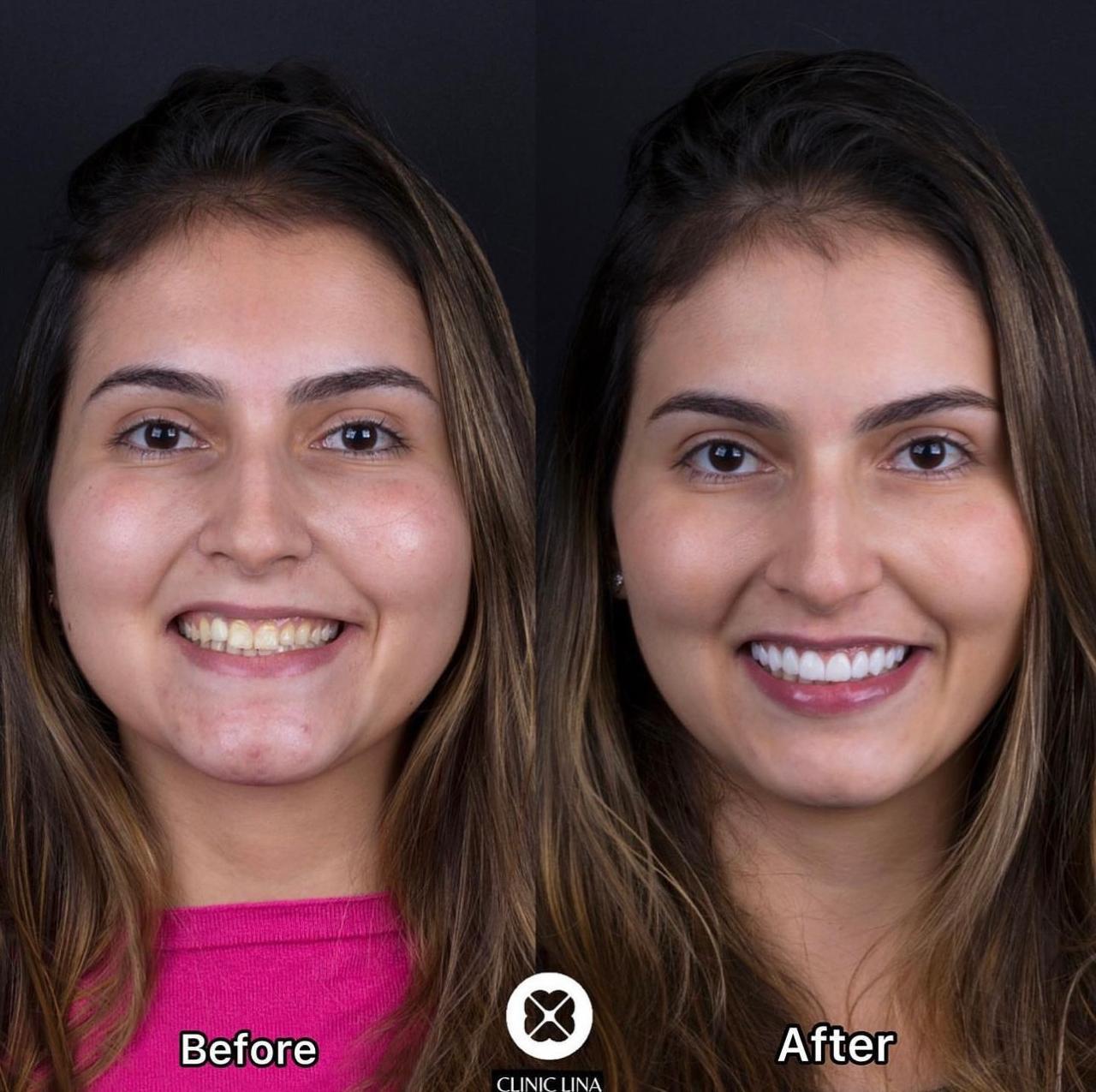 Urban Smiles Dental Care — Chembur