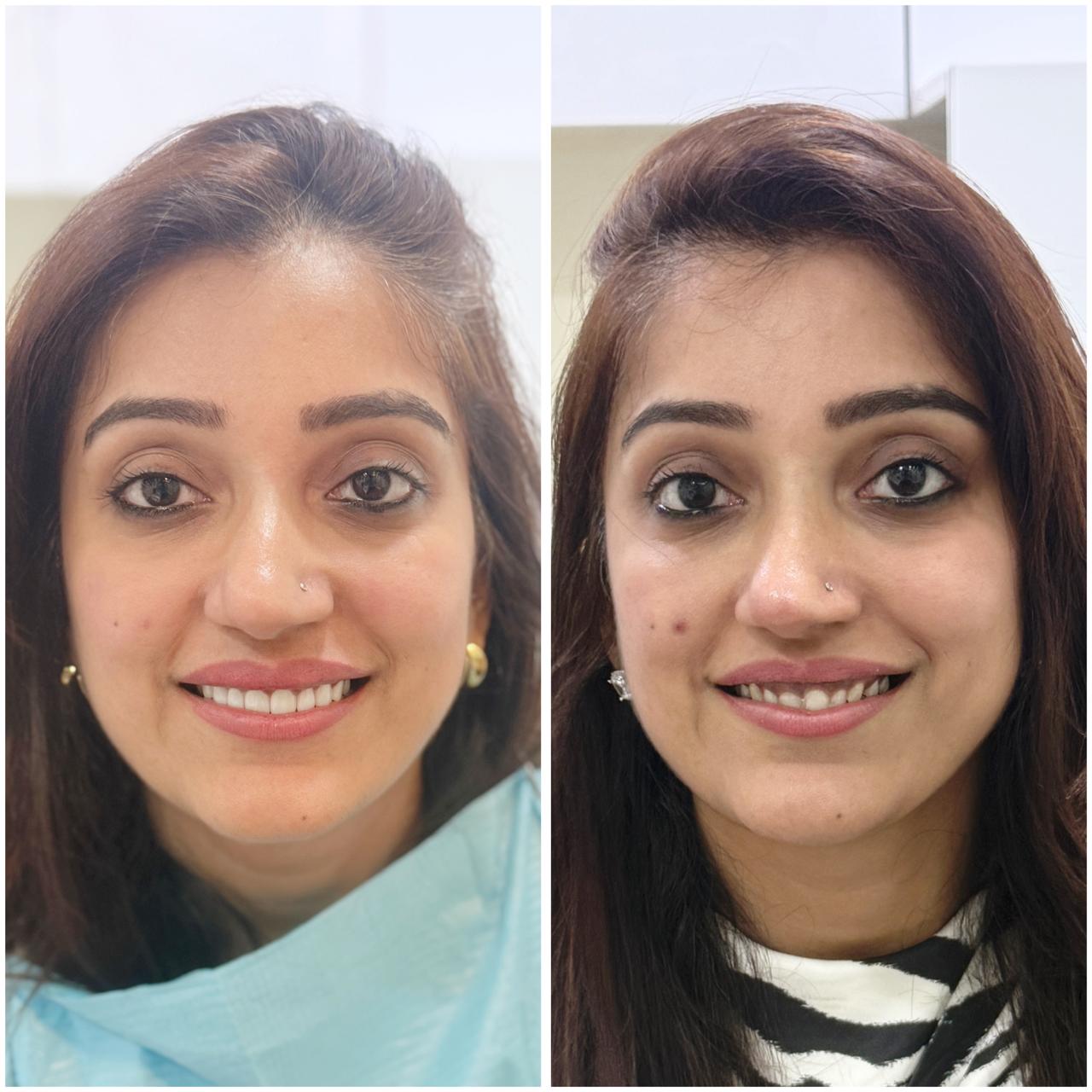 Urban Smiles Dental Care — Chembur
