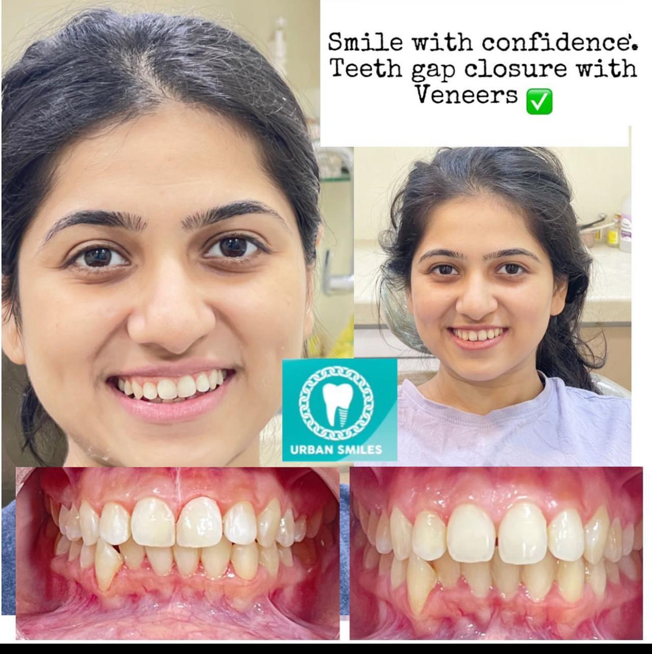 Urban Smiles Dental Care — Chembur