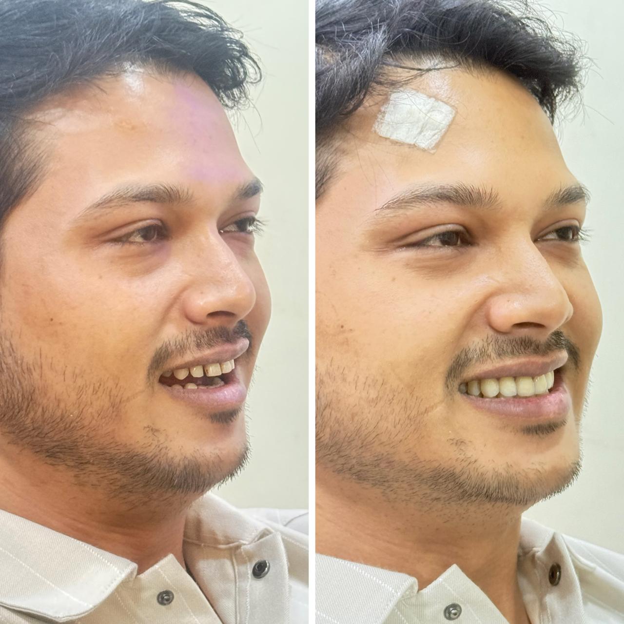 Urban Smiles Dental Care — Chembur